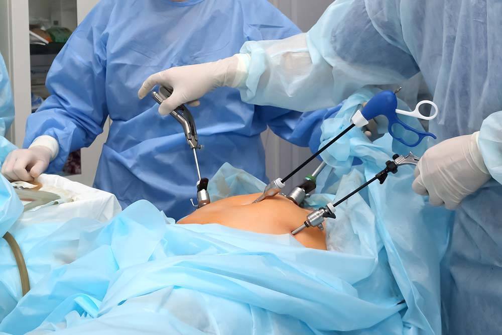 Surgical endoscopy